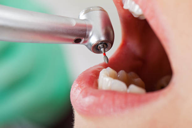 Best Dentist for Tooth Abscess  in Twin City, GA